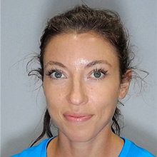 Emma Bates