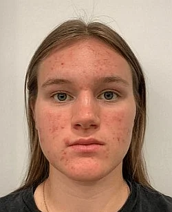 Emma Aicher