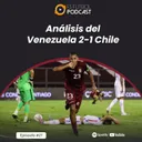 Ep. 21 - Análisis del Venezuela 2-1 Chile